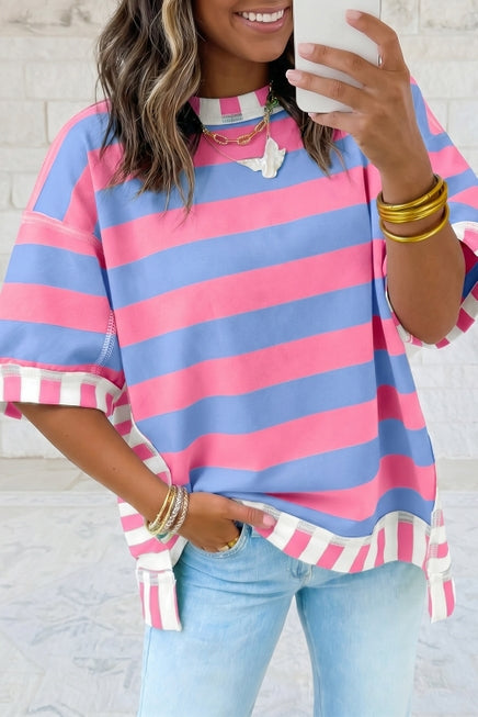 Relaxed Oversized Striped Top